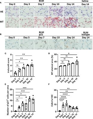 Senescence of alveolar epithelial cells impacts initiation and chronic phases of murine fibrosing interstitial lung disease